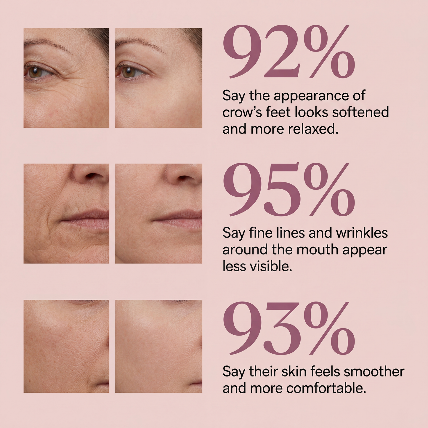 Patented Calcium Volume Multibalm